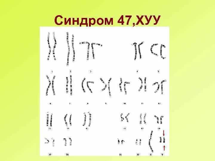 Песня уу хуу. Песня уу хуу