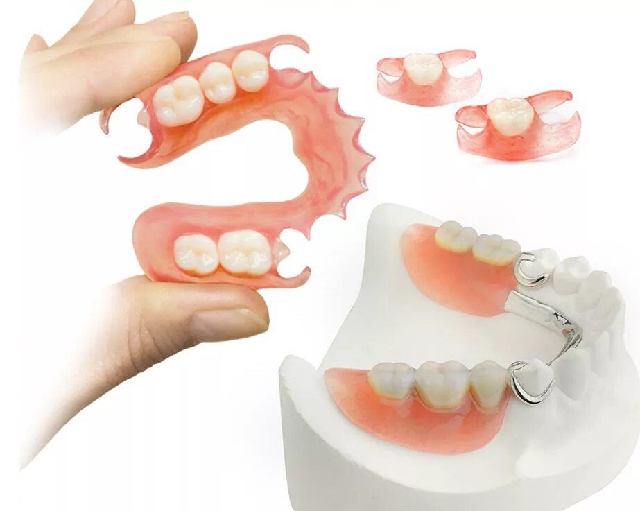 Передние и задние зубы какие. Нейлоновый бюгельный протез. Нейлоновый микропротез 1-3 зуба. Съемный протез (6-14 зубов) термо Джет.