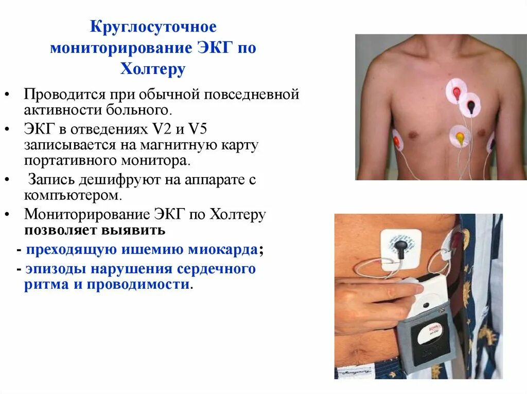 Суточное (холтеровское) мониторирование ЭКГ и АД в Челябинске