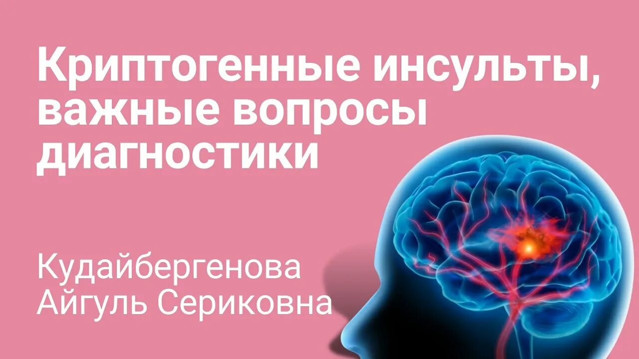 Криптогенный инсульт. ОНМК криптогенный Подтип. Фибрилляция предсердий и инсульт. Инсульт вопросы.