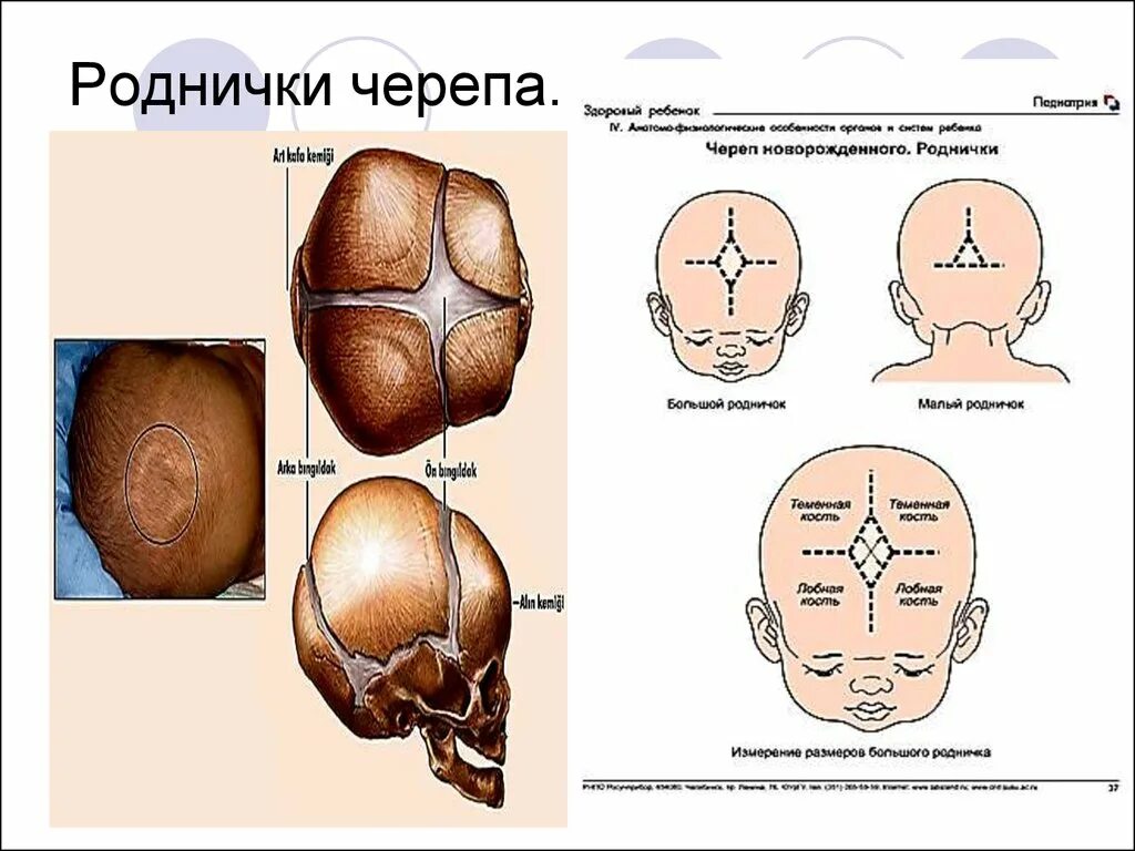 Роднички новорожденного анатомия черепа. Сосцевидный Родничок у новорожденных. Череп новорожденного 6 родничков. Форма родничков