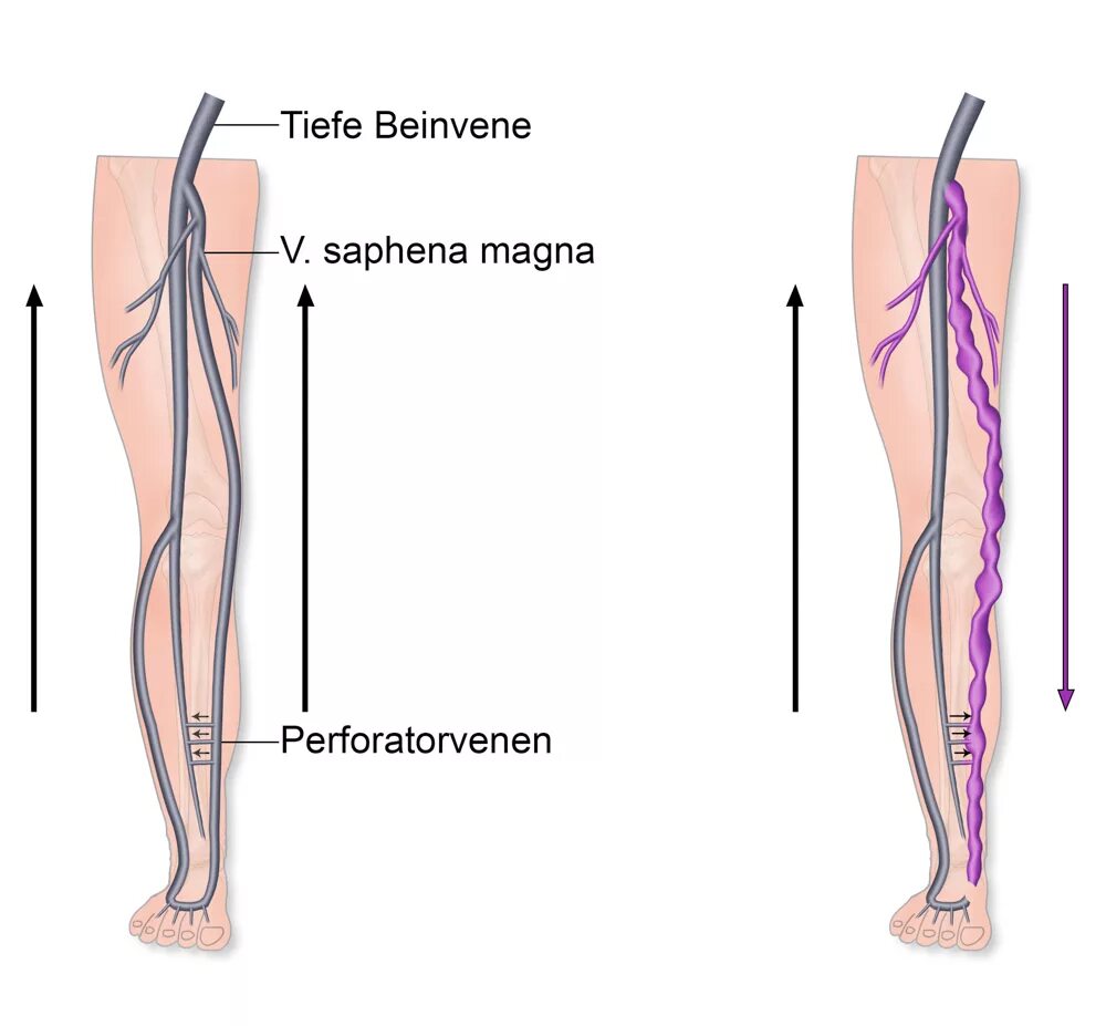Vena saphena. Вена сафена Магна. Вена сафена Магна анатомия. Вена сафена Магна на голени.