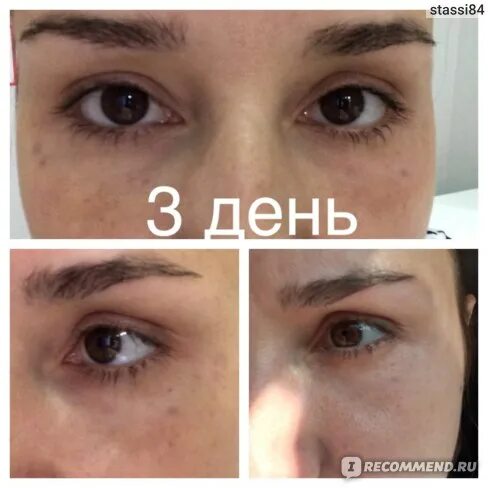 Дряблая, обвисшая кожа. После этой статьи, у вас будет понимание, как это исправ