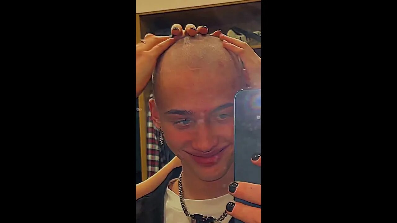 Дани милохин лапки. Милохин 2025 лысый.