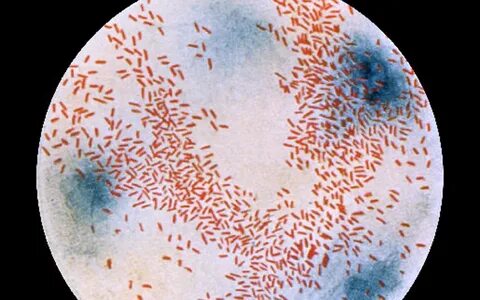 Инфекция вызванная haemophilus
