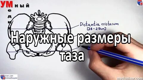 Размер таза индекс соловьевой