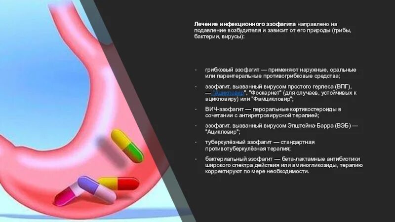 Эзофагит лечение отзывы. Инфекционный эзофагит. Лекарства при рефлюксе желудка. Морфологические формы эзофагита.