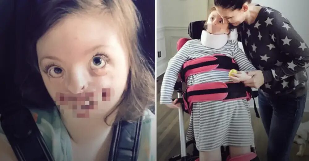 Синдром софии. Синдром ретта софия универ. Синдром софии. Синдром ретта. София уивер синдром ретта.