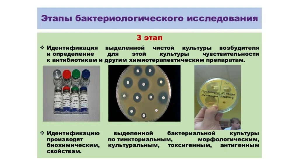 На данном этапе позволяет. Этапы бактериологического исследования. Этапы бактериологического метода исследования микробиология. Бактериологический метод исследования микроорганизмов. Этапы бактериологического исследования микробиология.