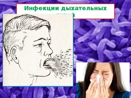 Инфекции верхних путей