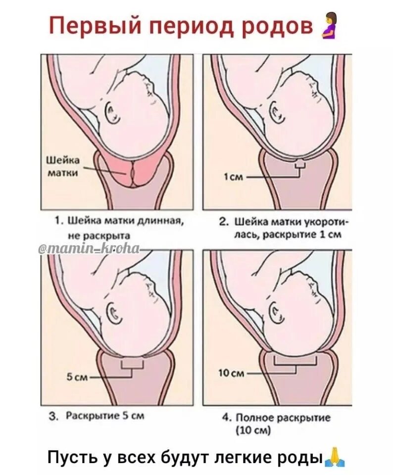 Раскрытие шейки при родах. Раскрытие шейки матки перед родами.