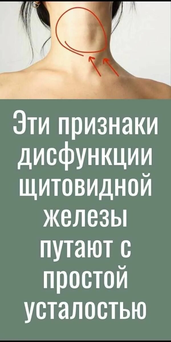 Заболевания связанные с нарушением функций щитовидной железы. Дисфункция щитовидной железы. Нарушение функции щитовидной железы. Дисфункция щитовидной железы симптомы. Дисфункция щитовидной железы у женщин.