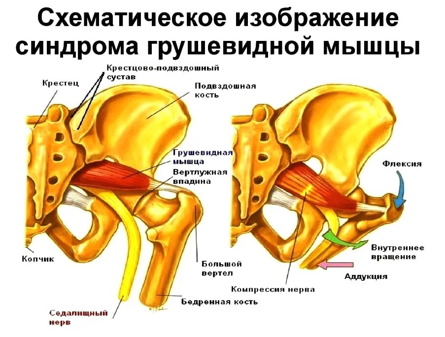 Крестцово подвздошные сочленения симптомы. Тазобедренный сустав анатомия грушевидная мышца. тазобедренный сустав грушевидная мышца. грушевидная мышца тазовые боли. крестцово остистая связка и грушевидная мышца.