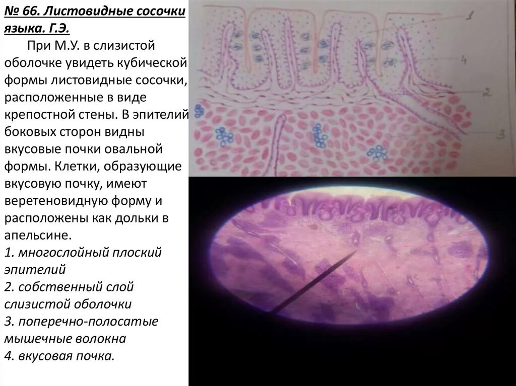 листовидные сосочки