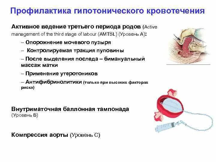 Профилактика послеродового кровотечения. Профилактика маточных кровотечений после родов. Профилактика послеродового гипотонического кровотечения.. Профилактика кровотечения в последовом периоде родов.