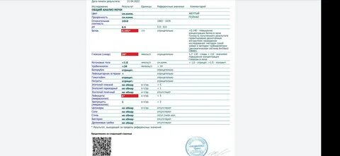 Уробилиноиды в моче