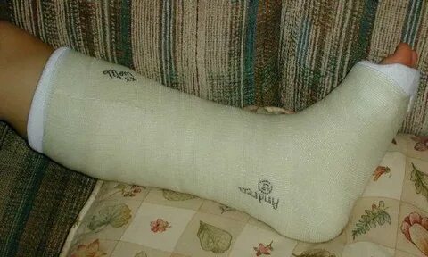 Гипсовая повязка сапожок