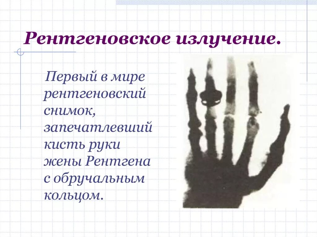 рисунок рентгеновского излучения. рисунок рентгеновского излучения.