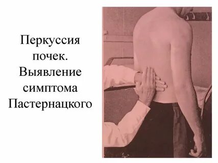 Пальпация почек