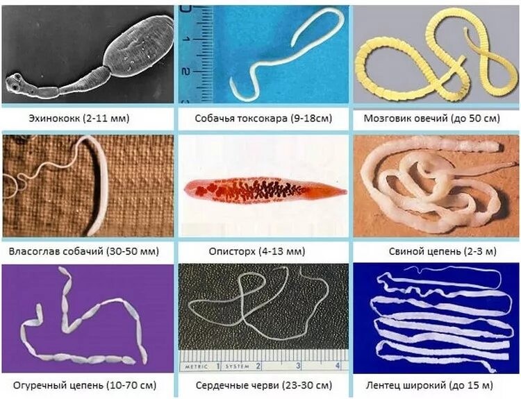 Признаки червей в организме человека. Паразитические черви гельминты и глисты. Глисты у человека скребни. Виды гельминтов паразитирующих в организме людей.