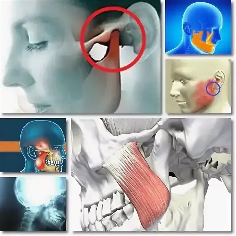 При открытии рта болит ухо. Болит челюсть возле уха и ухо. Болит челюсть около уха. Болит челюсть возле уха. Болит сустав челюсти около уха.