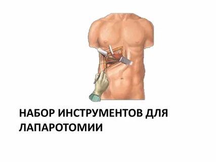 Набор для аппендэктомии