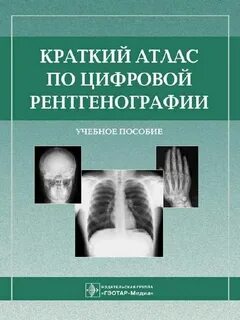 Атлас укладок