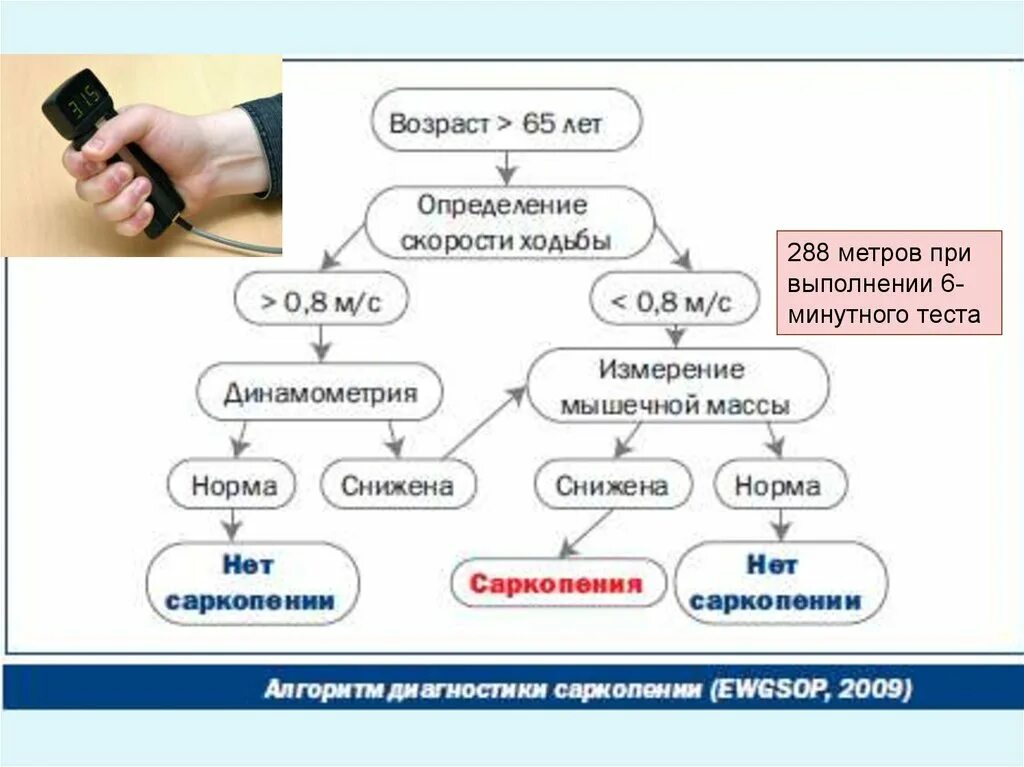 Саркопения у пожилых лечение отзывы. Диагностика саркопении. Алгоритм диагностики саркопении. Саркопения презентация. Диагностические критерии саркопении.