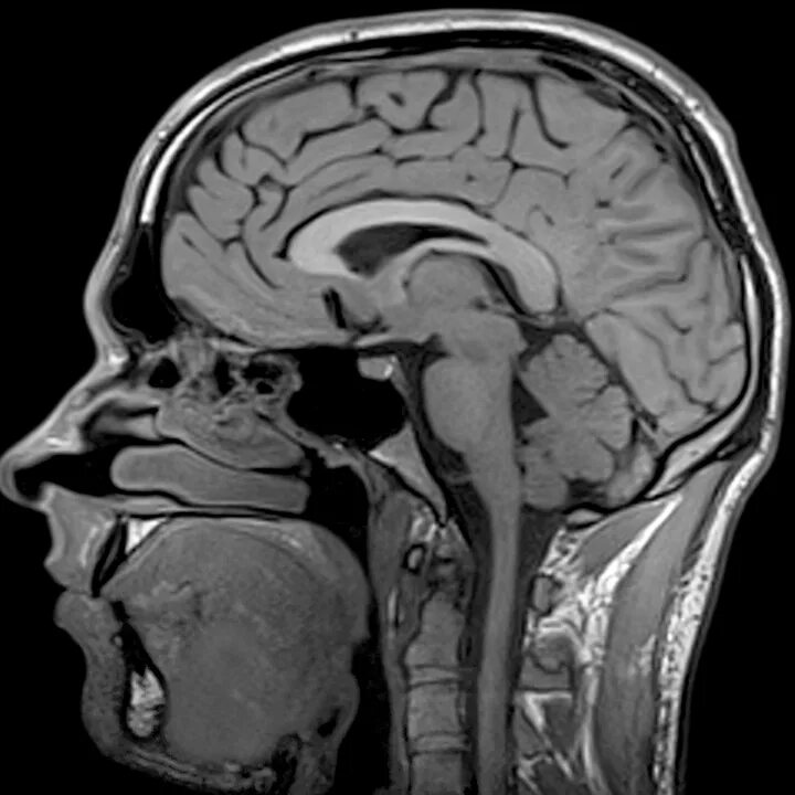 Мрт мягких тканей головы. M67 MRI. Мрт головного мозга. Мрт мозга.
