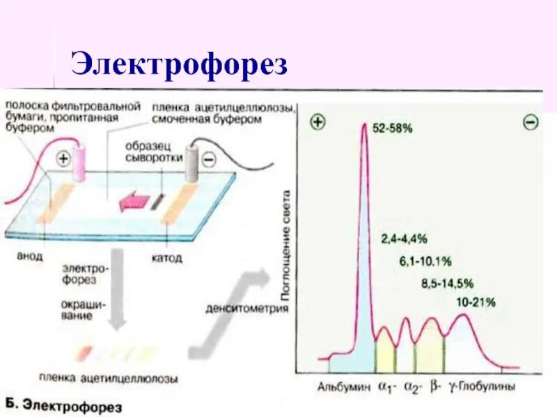 Тест песня электрофорез. Электрофорез. Электрофорез ДНК. Электрофорез белков плазмы крови. Электрофорез плакат.