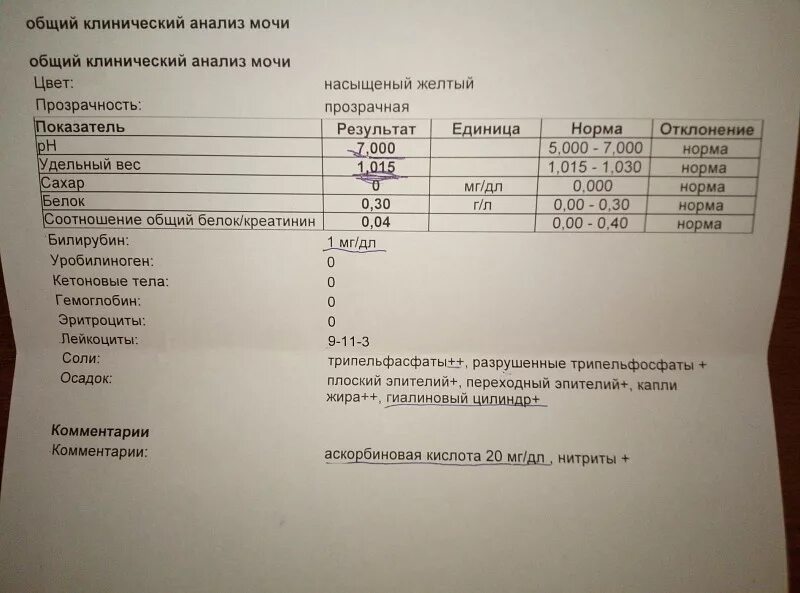 Микроальбумин в суточной моче повышен. Заключение анализа мочи. Исследование мочи общий анализ. Заключения при общем анализе мочи. МАУ анализ мочи.