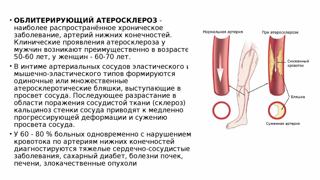 Атеросклероз сосудов нижних конечностей: симптомы, признаки и лечени � Здоровье 