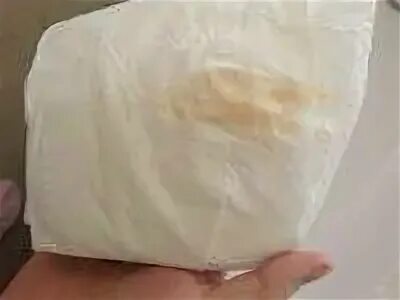 Выделения при раке у женщин