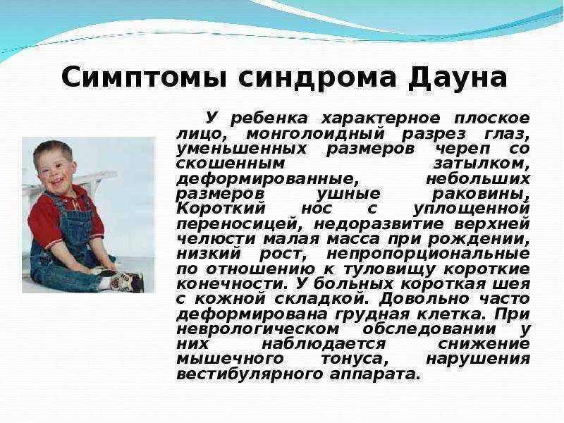 Болезнь дауна какой. Синдром Дауна внешние проявления. Симптоматика синдрома Дауна.