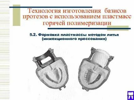 Методы изготовления протезов