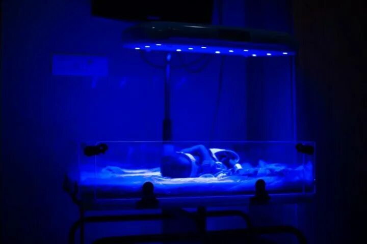 Фототерапия для новорожденных. Лампа для фототерапии новорожденных. Ультрафиолетовая лампа для детей от желтухи. Фототерапия для новорожденных при желтухе.