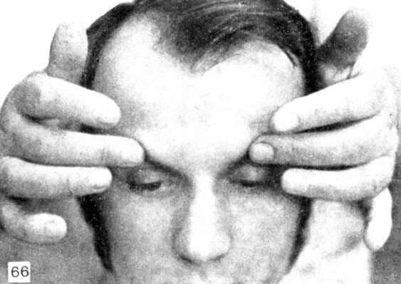 тройничный нерв лекарства. массаж при неврите тройничного нерва. массаж при невралгии тройничного нерва. неврит тройничного нерва лфк. болевые точки тройничного нерва.