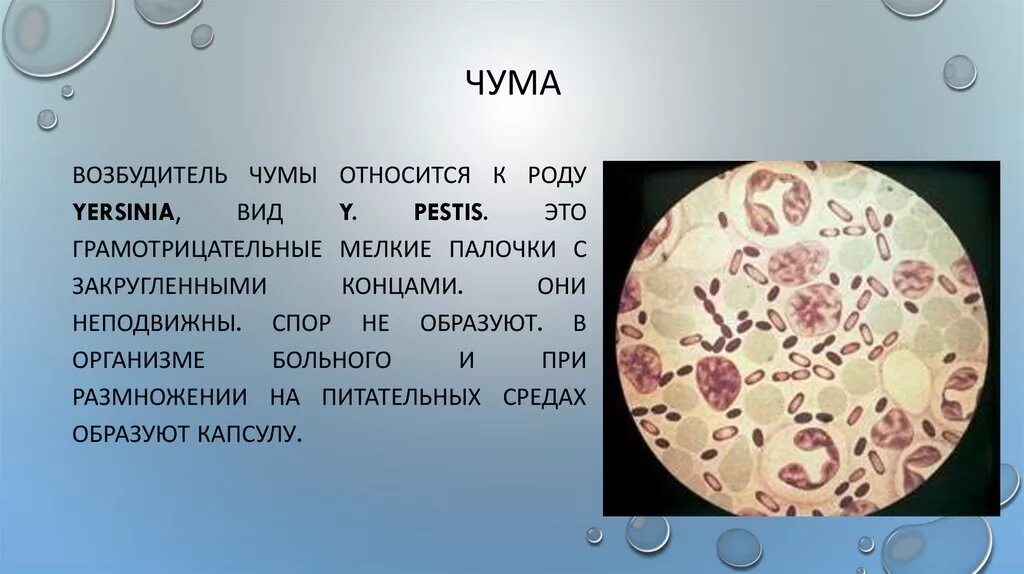 Чума заболевание вызываемые бактериями