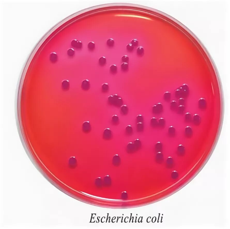 Энтеробактерии на агаре Мосселя. Кишечная палочка на среде Эндо. Escherichia coli на агаре Эндо. Escherichia coli на среде Эндо. Среда для кишечной палочки