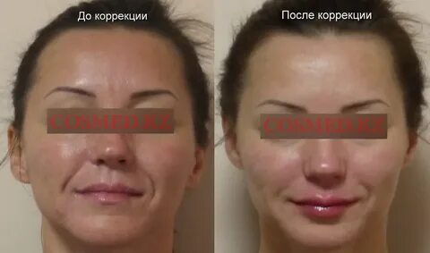 Что нельзя после коррекции