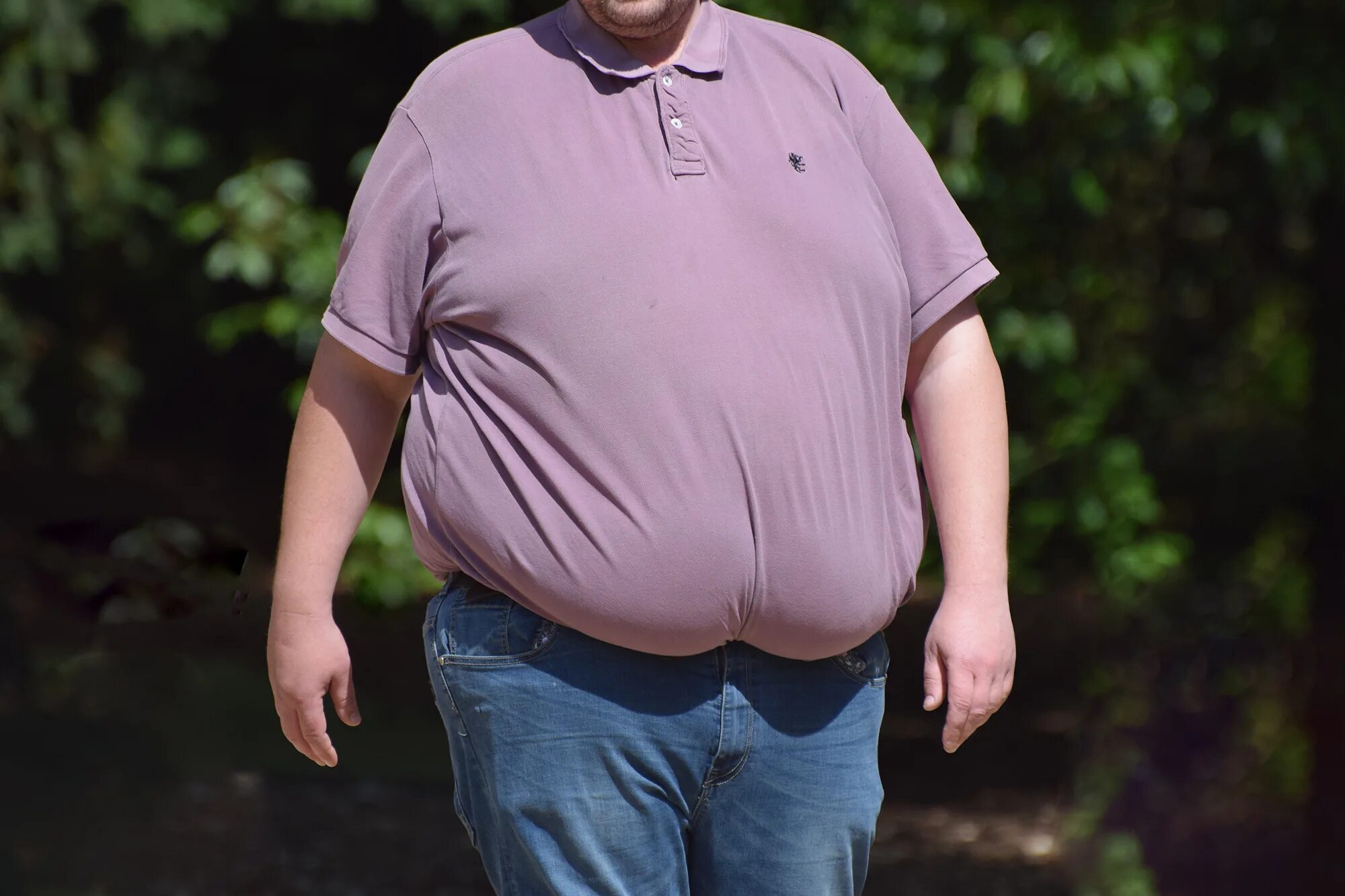 Толстый мужчина. Ожирение.