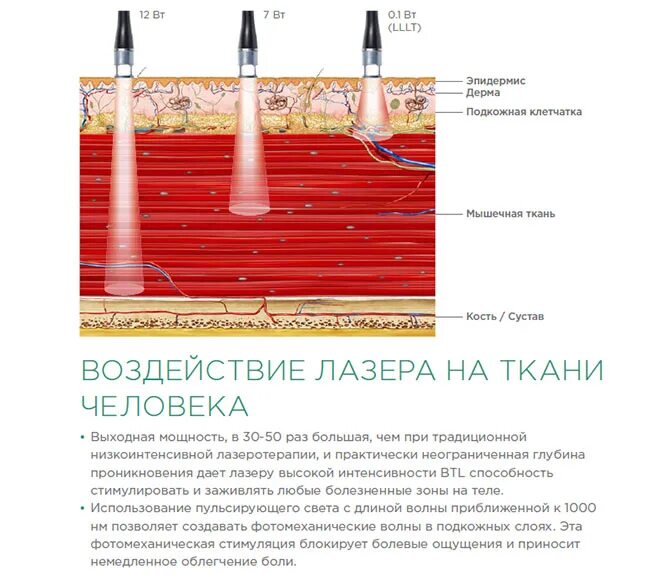 Лазер влияет. Глубина проникновения лазерного излучения. воздействие лазера на биологические ткани. механизм действия лазера. воздействие лазера на ткани.