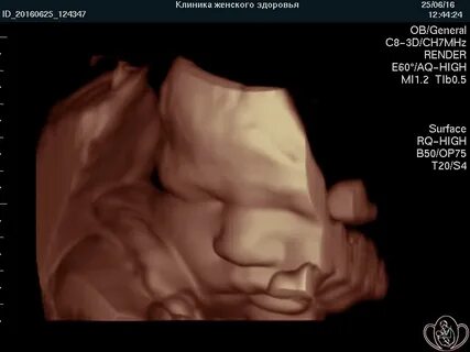 30 недель 5 дней беременности