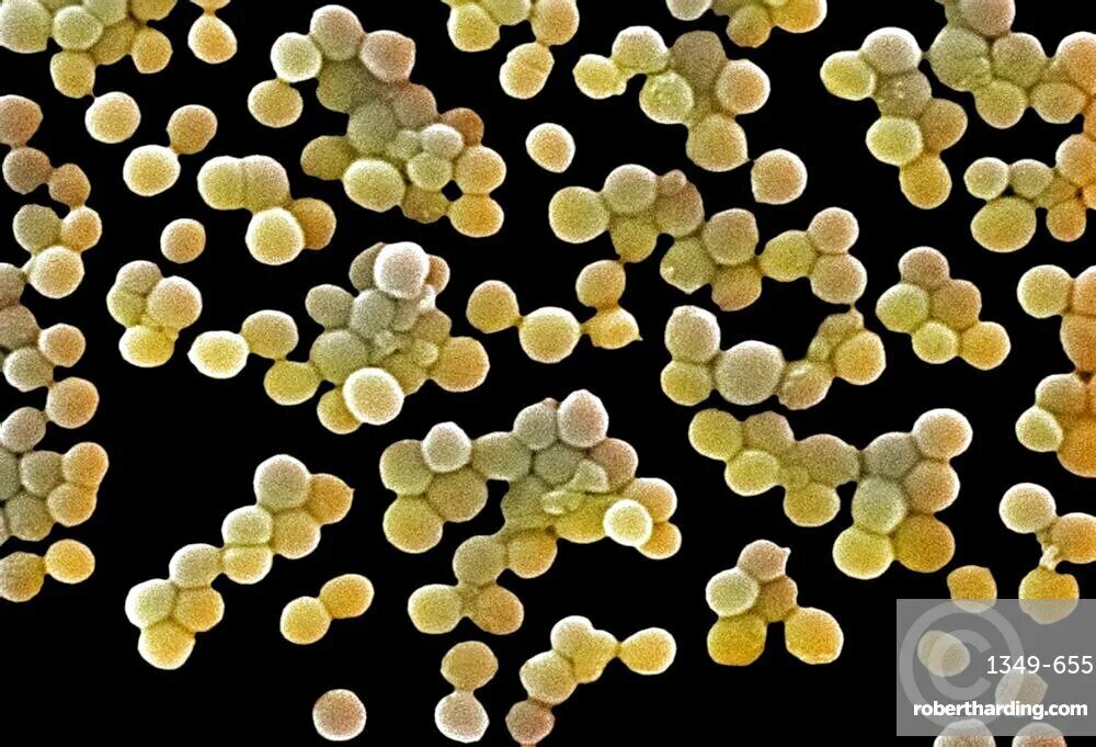 Staphylococcus aureus золотистый стафилококк. Стафилококкус ауреус. Золотистый стафилококк с10. Бактерии стафилококки.