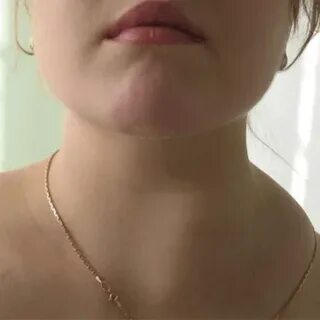Лимфаденопатия код