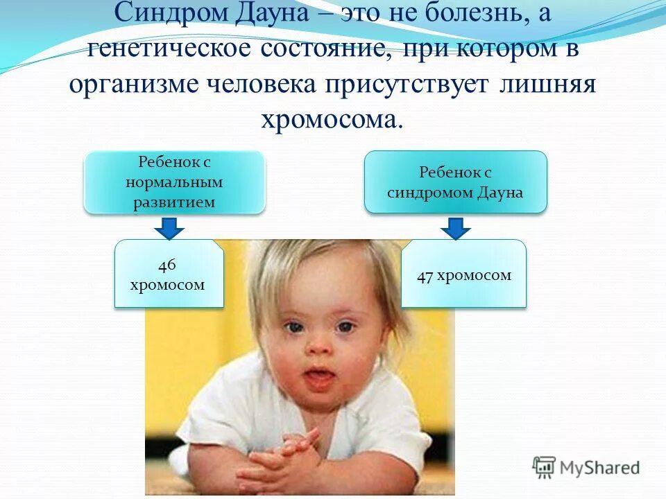 Мероприятия синдром дауна. Развитие детей с синдромом Дауна. Дети с синдромом Дауна презентация. Памятка по синдрому Дауна. Особенности развития детей с синдромом Дауна.