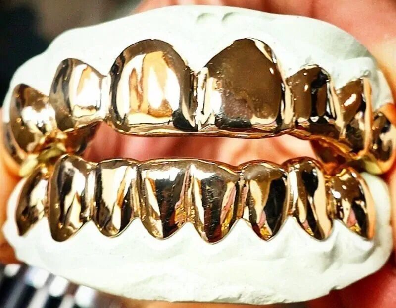 Штампованные коронки на зубы. Silver Grillz. Штампованная коронка с напылением. Металлическая коронка. Золотые зубные коронки.