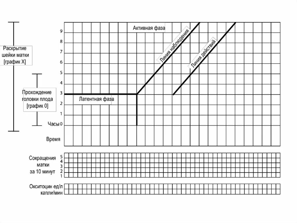 Партограмма в акушерстве образец. Партограмма раскрытия шейки матки. Партограмма родов пример. Партограмма бланк. Катетер перед родами для раскрытия шейки матки