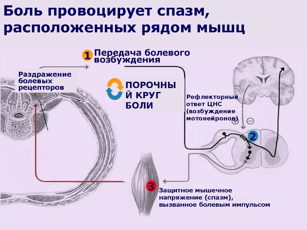 Механизм возникновения мышечного спазма. Спастическое сокращение мышц. Механизм возникновения мышечной боли. Механизмы спастичности мышц. Болевые колики