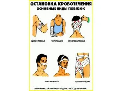 Виды повязок тест